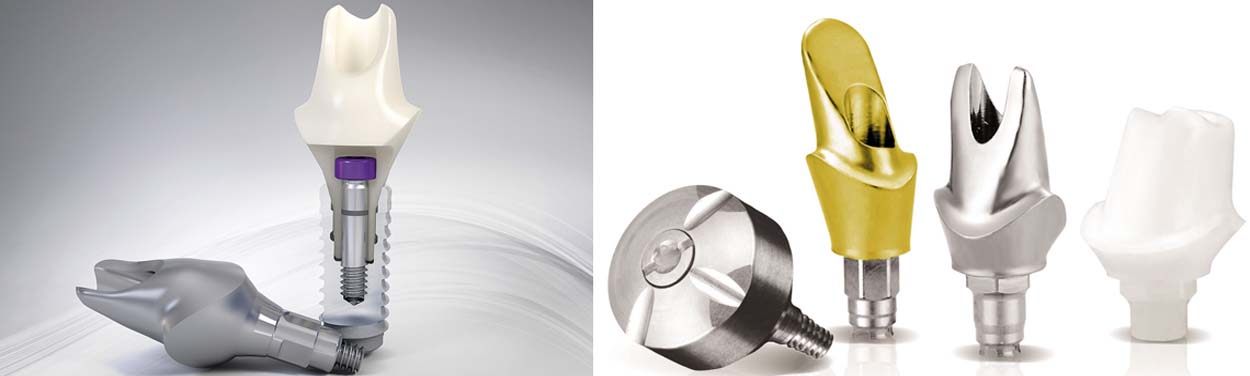 Dental Implants Materials